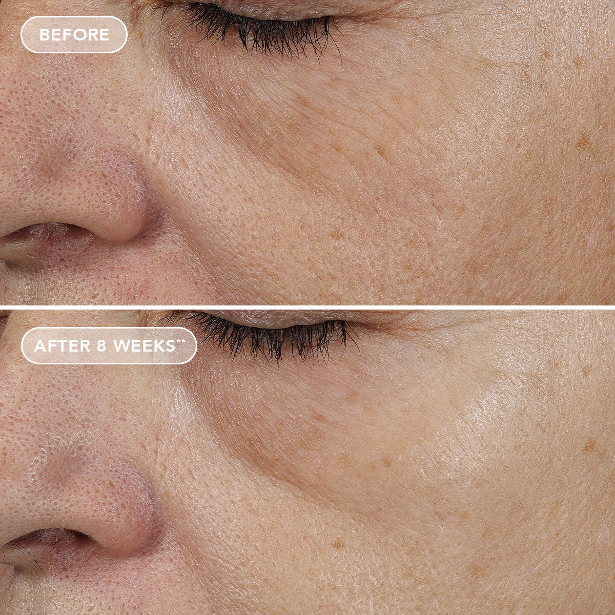 Image Skincare AGELESS+ Retinol Overnight Masque | Renew + Smooth
